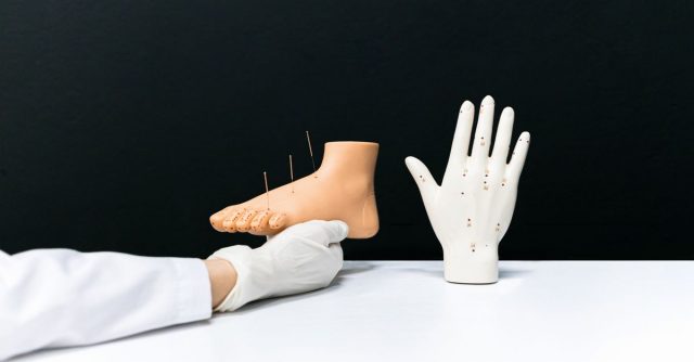 美容鍼が意味ないと感じる理由を整体師が解説