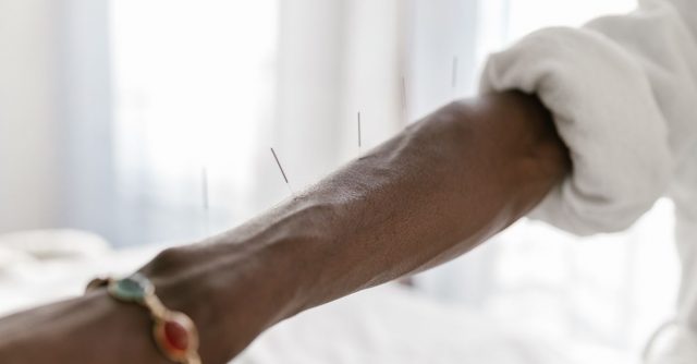 鍼灸で神経を傷つけられた？知恵袋で見る症状の実態